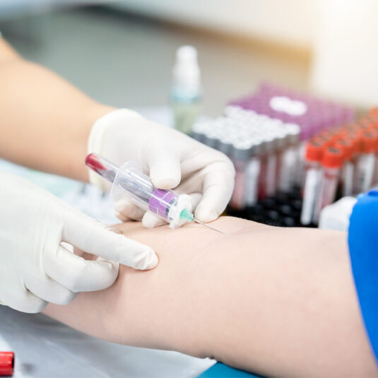 blood test