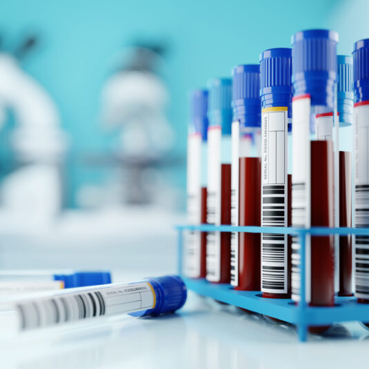 blood vial