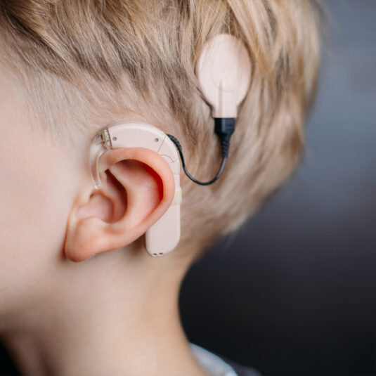 Child wearing a Cochlear implant