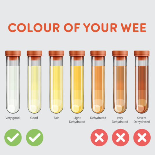 Urine colour hydration chart ranging from clear to dark brown, demonstrating signs of hydration and dehydration levels.