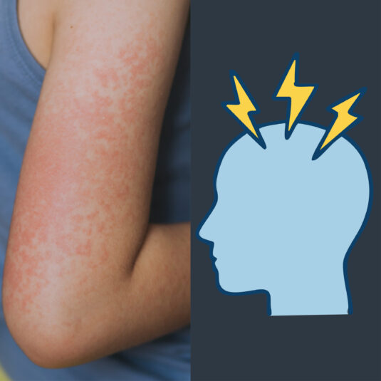 Close-up of a red skin rash next to an icon of a head with pain symbols, representing rash and headache symptoms that may need medical attention.